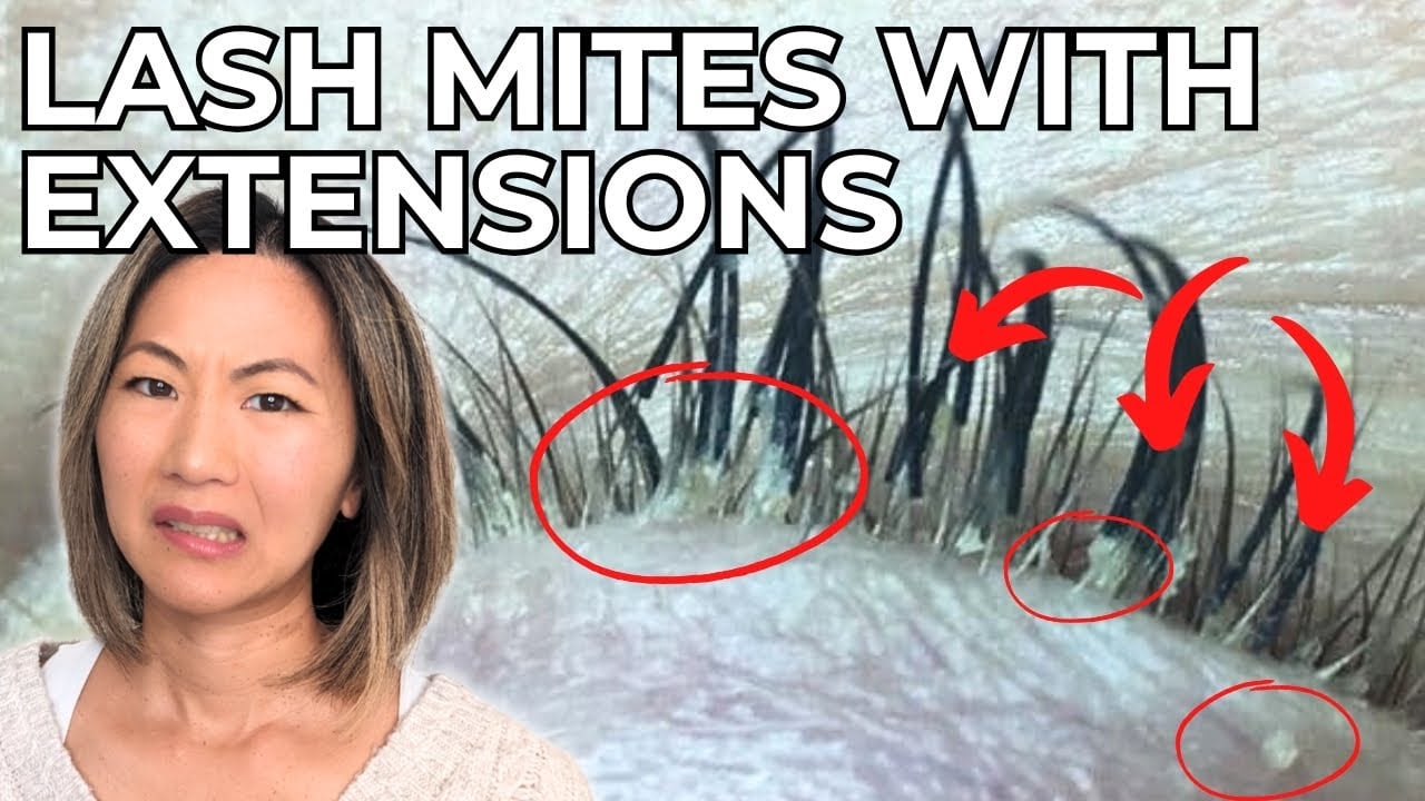 EYELASH MITES – The Truth About Eyelash Extensions & How to Get Rid of Them!