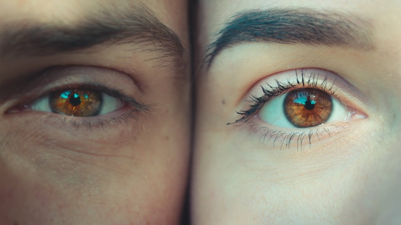 What is a stye? | Patient Explainers