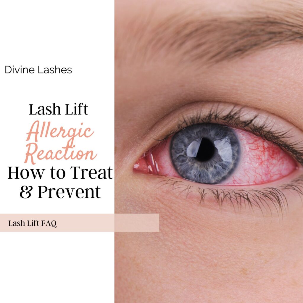 Lash Lift Allergic Reaction How to Treat & Prevent