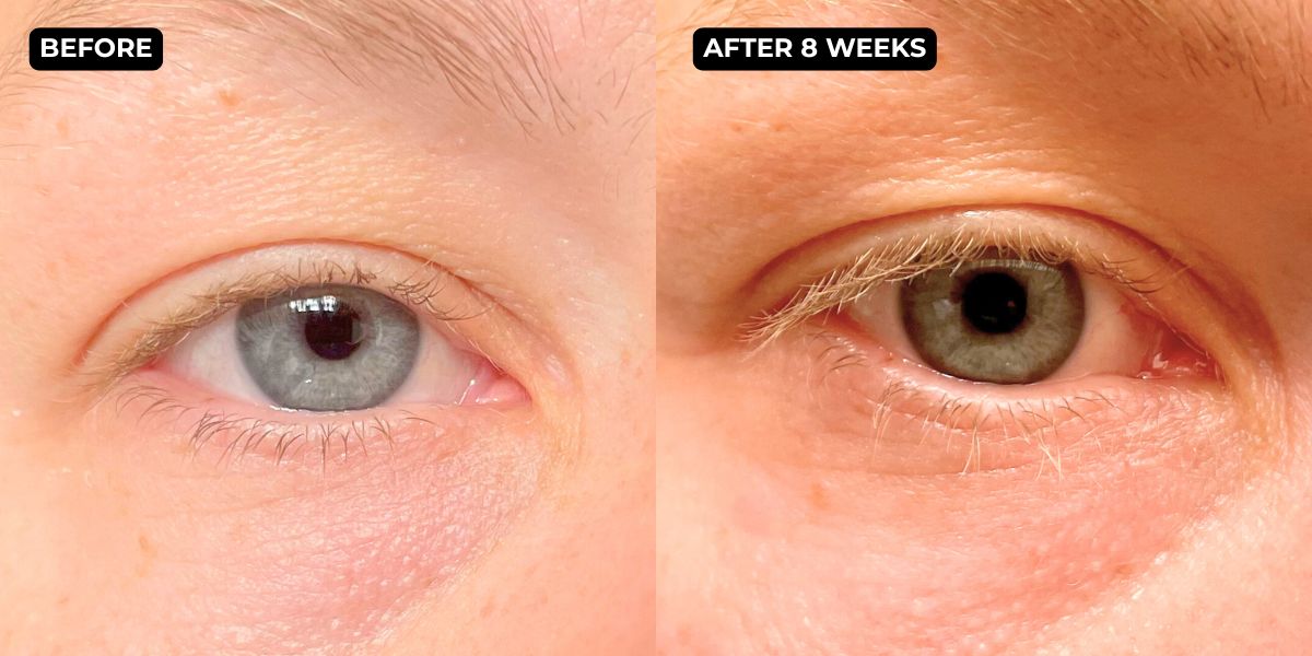 Lash serum before after 3