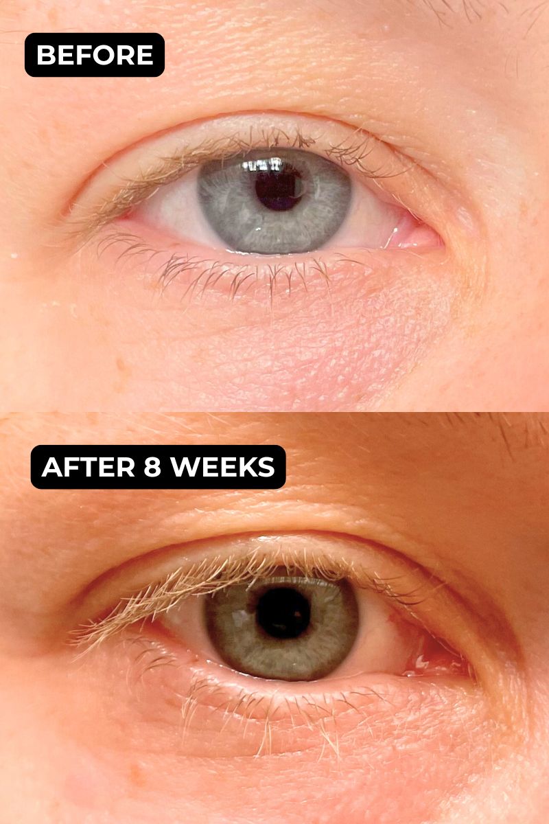 Lash serum before after 5 800x1200